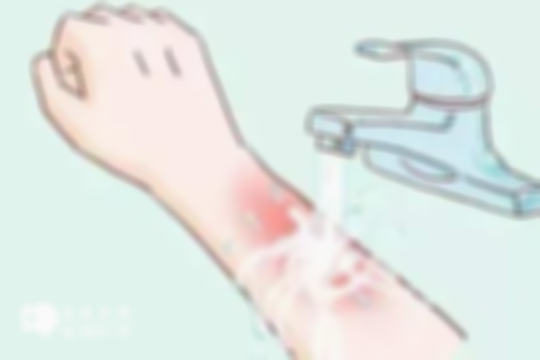 宝宝意外出血急救方法：烧伤烫伤+溺水处理指南