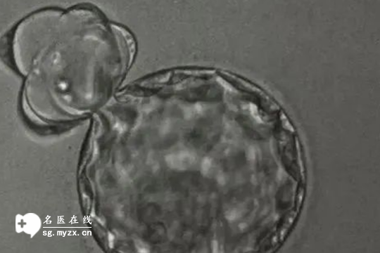 试管生孩子多少钱？解读2025格鲁吉亚第三代试管婴儿详情价格明细！