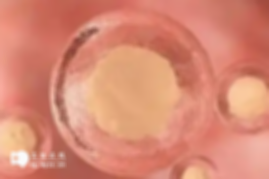 云南做第三代试管婴儿的费用大概多少钱？不知道的就来看