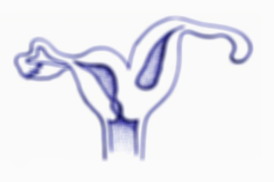 女性单角子宫还能正常怀孕吗？分享4大助孕妙招