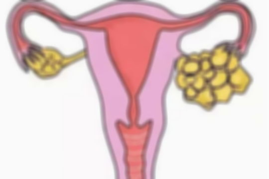 女性卵巢功能下降有哪些表现？月经不调、不孕、情绪波动等都要重视