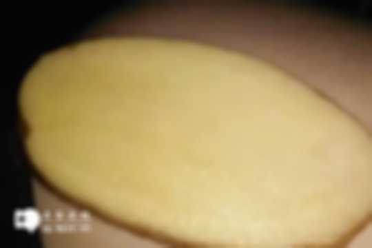 取卵后打黄体酮的作用解读：不仅维护子宫稳定还提高着床率