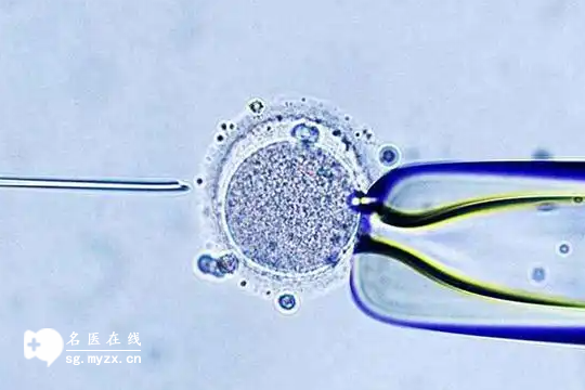 新标准：海口做试管婴儿三代的费用明细整理，预算心中知
