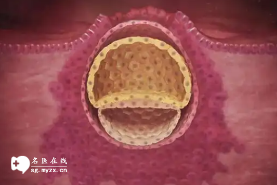 一文看懂影响5CA囊胚着床率的5大关键因素！