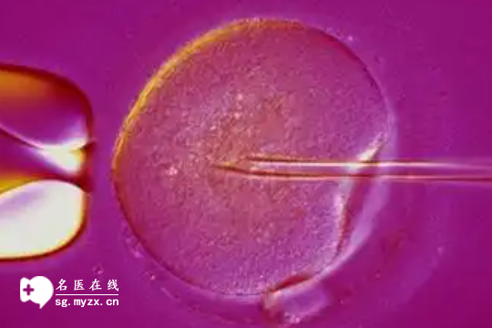 多囊促排为何还是怀不上？原因有5点，来了解！