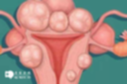 子宫肌瘤对女性身体的危害解读：破溃感染、影响生育都需重视！