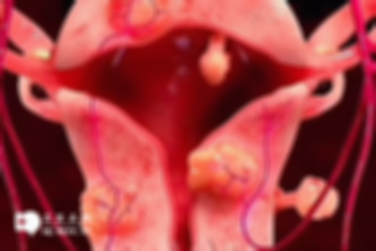 子宫肌瘤和子宫囊肿有差异，这两大要点一定要了解清楚！