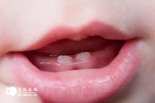 科普 | 宝宝乳牙萌出的三大异常现象是什么？每一种都需重视！