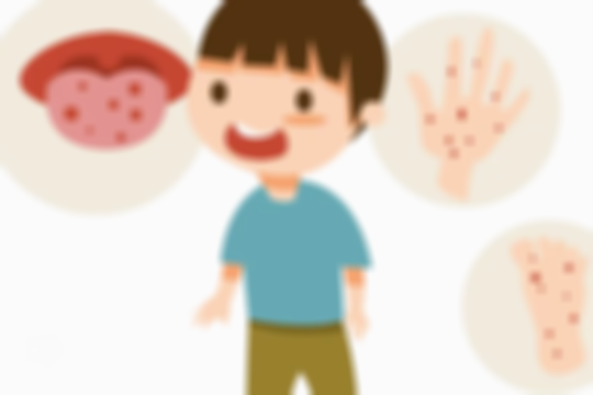 手上起泡可能是哪些病症？早期五大症状，你真的了解吗？