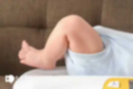 新生儿出现的6种“异常”一览，时刻观察能救命，宝妈别慌张