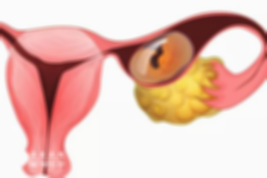 冻胚移植后小心腹痛、阴道出血，小心是异位妊娠！
