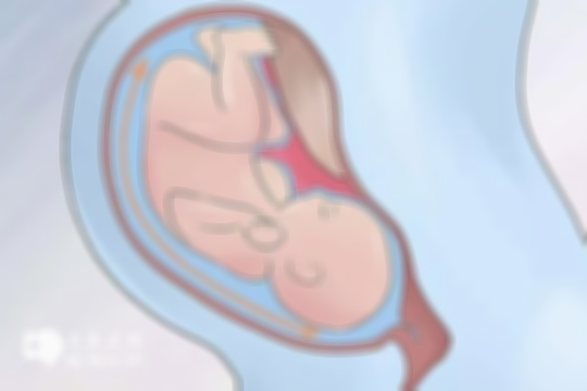 女性怀孕羊水少，胎儿畸形、子宫感染、早产等风险大，你都了解吗？