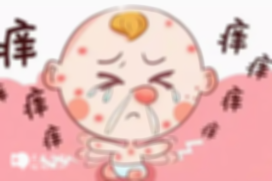 医生不建议查过敏源的说法不准确，婴儿出现这3大情况，请及时就医
