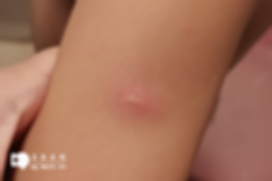 宝宝打完疫苗当天，不建议洗澡！这3大注意事项赶紧来看看