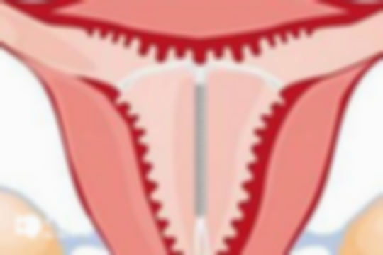 女性提前闭经的危害分析：是否提前衰老，文中已有答案