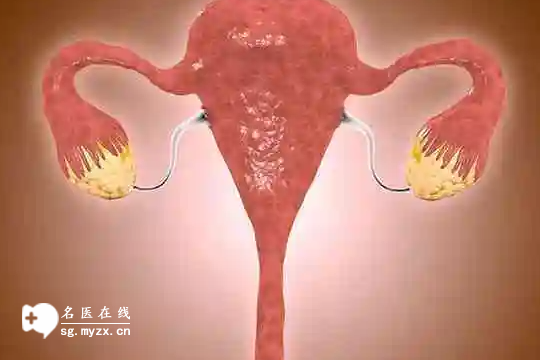 单侧巧囊不促排并非不能怀孕！4大有效治疗方法，不妨尝试一下