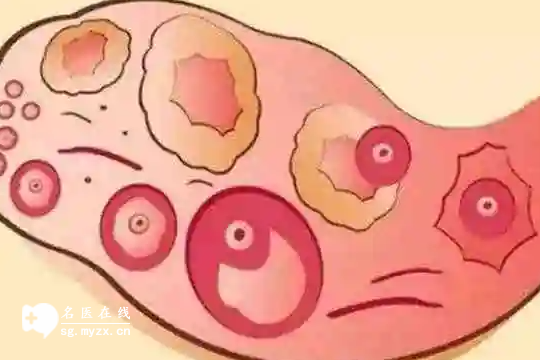 促排后卵泡不均匀怎么办？三大实用小妙招，有效规避风险