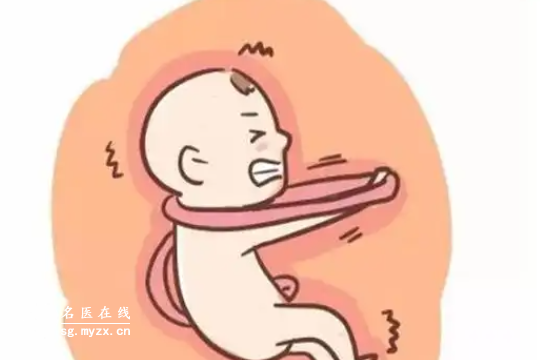 脐带绕颈一周影响分析：能否顺产、是否缺氧、如何解决等问题专家一一解答！