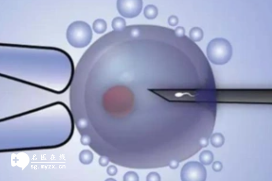2025版四川做第三代试管婴儿的费用详解及预算准备指南一览！