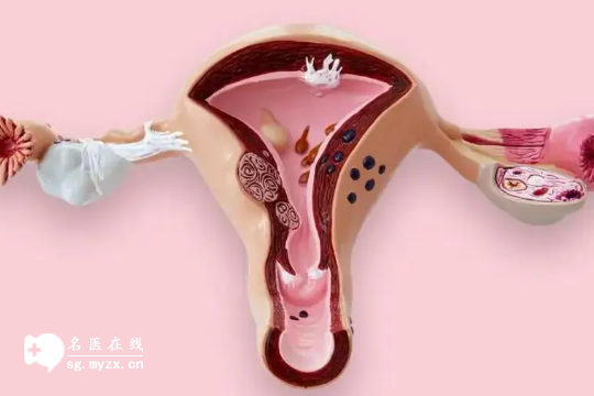 涨知识了！子宫腺肌症打降调有什么好处，竟然有利于着床