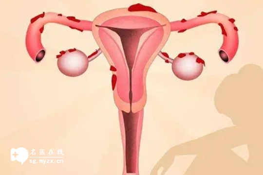 刚生完孩子子宫就下垂怎么办？分享3大治疗方法，让你重回身材巅峰