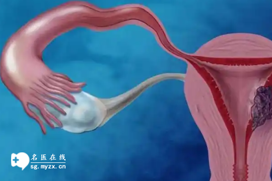 内膜3mm并非不能生育！掌握这4大调理方法，来月经还有救