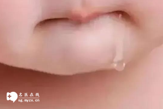 宝宝流口水很常见，除了长牙还需警惕这4种疾病，家长必读！