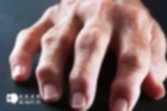 早晨醒来手指发胀警惕四种疾病，肾病、痛风等都会出现，尽早治疗至关重要！