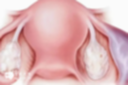 胚胎移植后子宫有下坠感的原因分析：除了生化妊娠，还有这4大因素在作祟！