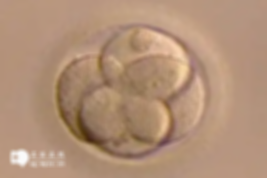 取卵31个移植鲜胚真的可行吗？专家提醒：切勿冲动！小心一颗都不存活