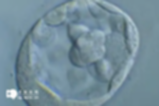 优质囊胚染色体异常概率10%以下，若移植失败，这3大原因需重视！