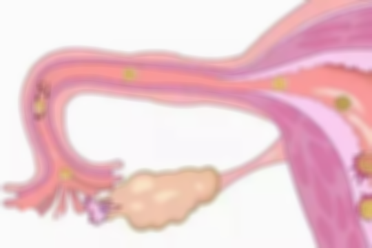 卵泡过大不排的五大原因揭晓，第三点有80%的女性“中招”都没察觉！