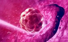 试管是怎么移植到子宫的